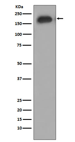 Anti-Phospho-EGFR (Y1092) Rabbit Monoclonal Antibody Boster Bio