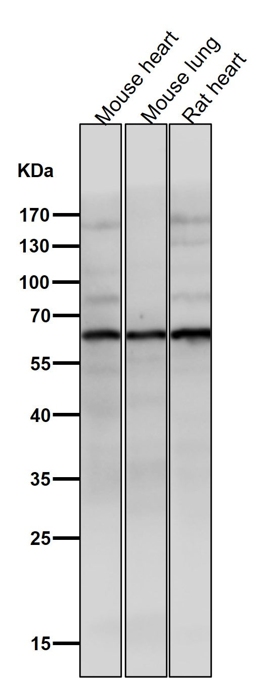 Anti-Phospho-AKT1 (S129) Rabbit Monoclonal Antibody Boster Bio
