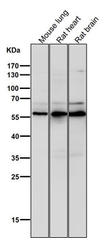 Anti-Phospho-AKT1 (S124) Rabbit Monoclonal Antibody Boster Bio