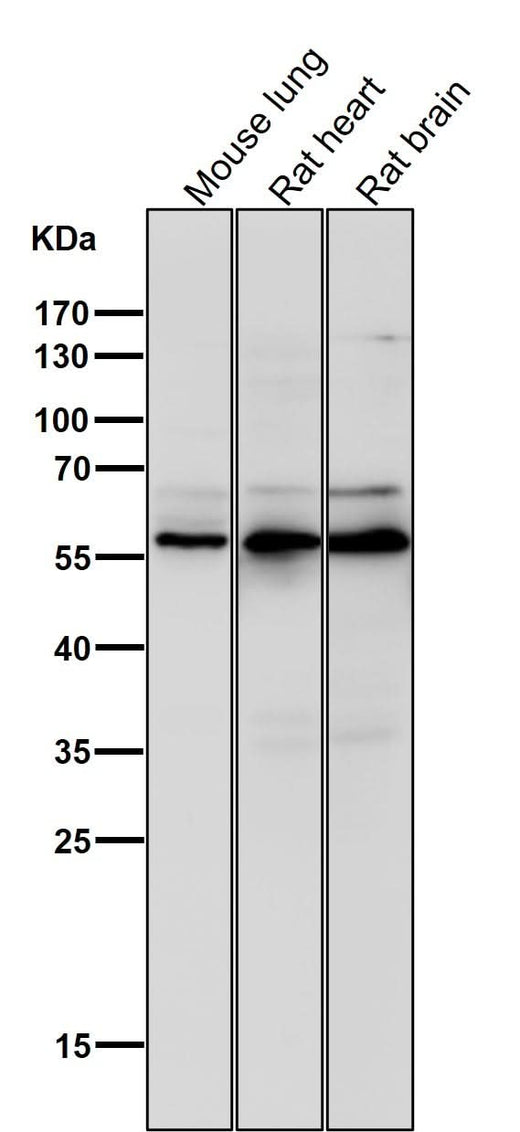 Anti-Phospho-AKT1 (S124) Rabbit Monoclonal Antibody Boster Bio