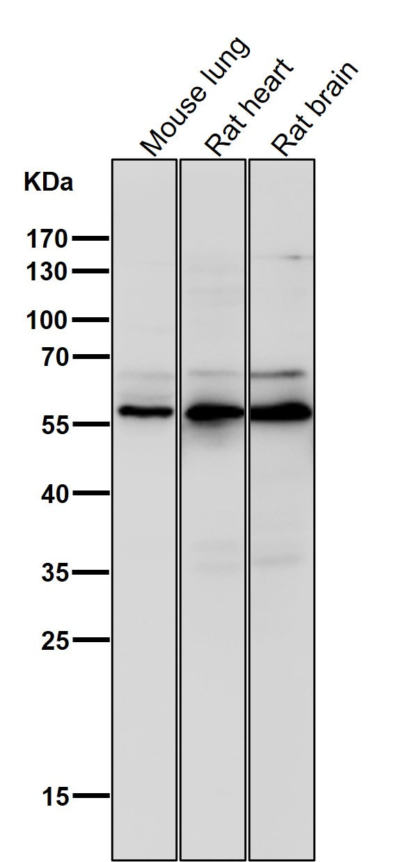 Anti-Phospho-AKT1 (S124) Rabbit Monoclonal Antibody Boster Bio