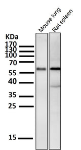 Anti-Phospho-Akt (Ser473) AKT1 Rabbit Monoclonal Antibody Boster Bio