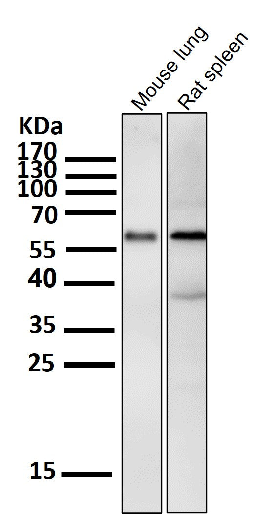 Anti-Phospho-Akt (Ser473) AKT1 Rabbit Monoclonal Antibody Boster Bio