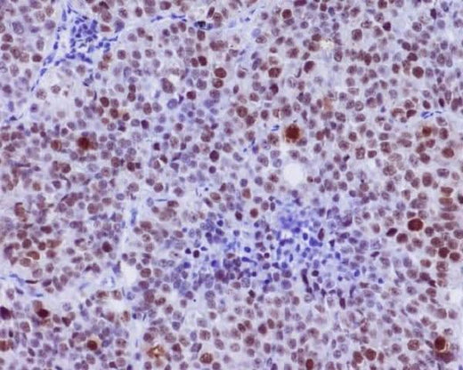 Anti-Phospho-c-Myc (S62) Rabbit Monoclonal Antibody Boster Bio