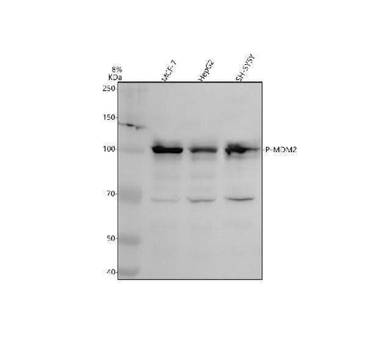 Anti-Phospho-MDM2 (S166) Rabbit Monoclonal Antibody Boster Bio