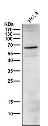 Anti-Phospho-ER alpha (S118) ESR1 Rabbit Monoclonal Antibody Boster Bio