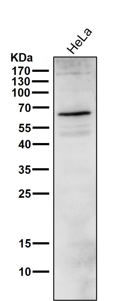 Anti-Phospho-ER alpha (S118) ESR1 Rabbit Monoclonal Antibody Boster Bio