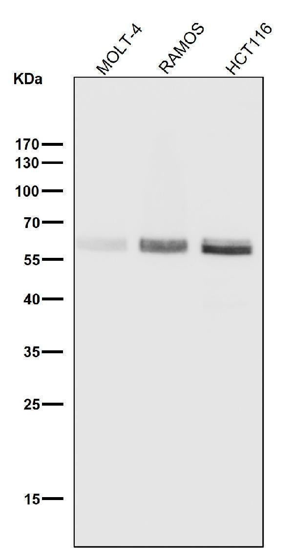 Anti-Phospho-Smad3 (S423 + S425) Rabbit Monoclonal Antibody Boster Bio