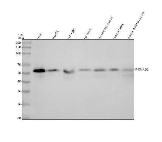 Anti-Phospho-Smad2 (S250) Rabbit Monoclonal Antibody Boster Bio