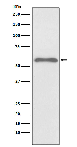 Anti-Phospho-Smad2 (S255) Rabbit Monoclonal Antibody Boster Bio