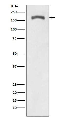 Anti-Phospho-PDGF Receptor beta (Y740) PDGFRB Rabbit Monoclonal Antibody Boster Bio
