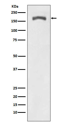 Anti-Phospho-PDGF Receptor beta (Y740) PDGFRB Rabbit Monoclonal Antibody Boster Bio