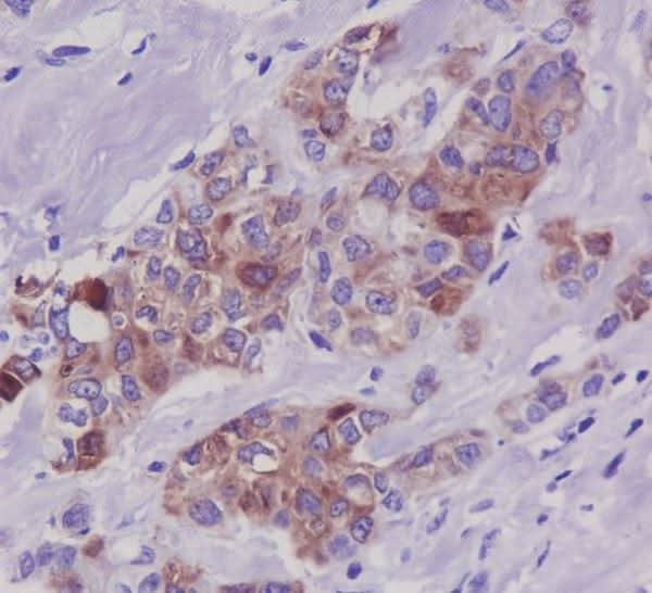 Anti-Phospho-Tau (S396) MAPT Rabbit Monoclonal Antibody Boster Bio