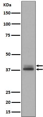 Anti-Phospho-Erk1 (T202/Y204) + Erk2 (T185/Y187) MAPK3 Rabbit Monoclonal Antibody Boster Bio