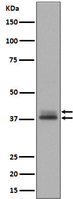 Anti-Phospho-Erk1 (T202/Y204) + Erk2 (T185/Y187) MAPK3 Rabbit Monoclonal Antibody Boster Bio