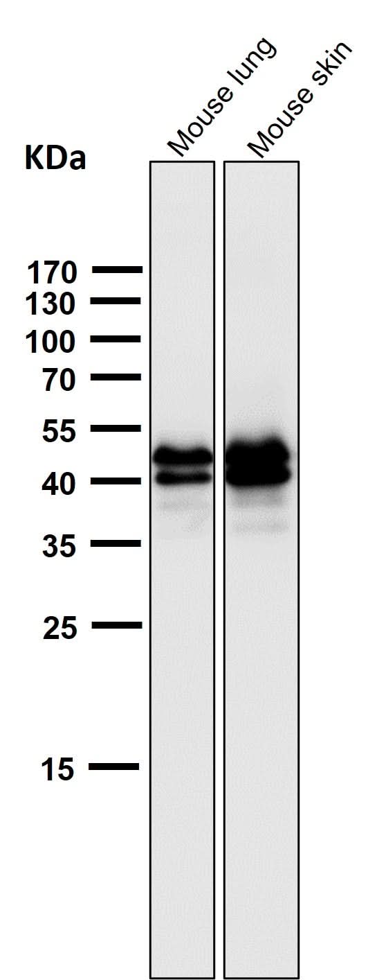 Anti-Phospho-ERK1 (T202) + ERK2 (T185) Rabbit Monoclonal Antibody Boster Bio