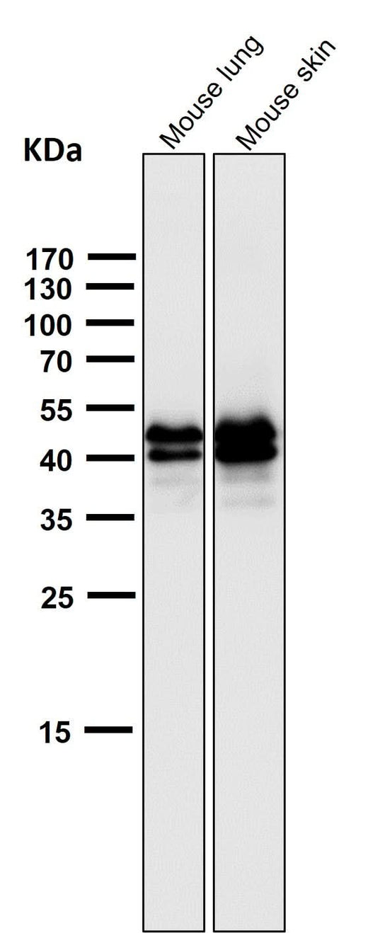 Anti-Phospho-ERK1 (T202) + ERK2 (T185) Rabbit Monoclonal Antibody Boster Bio