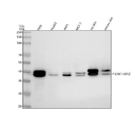 Anti-Phospho-Erk1 (T202/Y204) + Erk2 (T185/Y187) MAPK3 Rabbit Monoclonal Antibody Boster Bio