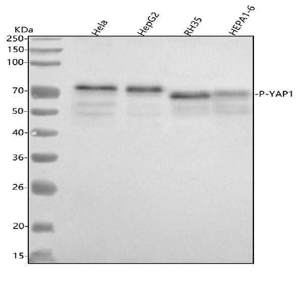 Anti-Phospho-YAP1 (S127) Rabbit Monoclonal Antibody Boster Bio