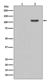 Anti-Phospho-FAK (Y397) PTK2 Rabbit Monoclonal Antibody Boster Bio