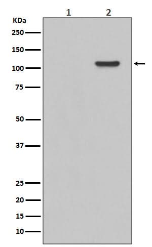 Anti-Phospho-FAK (Y397) PTK2 Rabbit Monoclonal Antibody Boster Bio