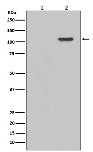 Anti-Phospho-FAK (Y397) PTK2 Rabbit Monoclonal Antibody Boster Bio