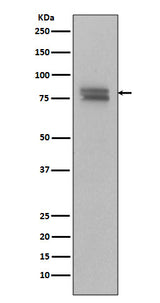 Anti-Phospho-v-Myb + c-Myb (S11) Rabbit Monoclonal Antibody Boster Bio