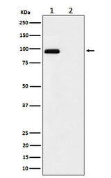 Anti-Phospho-FGFR3 (Y724) Rabbit Monoclonal Antibody Boster Bio