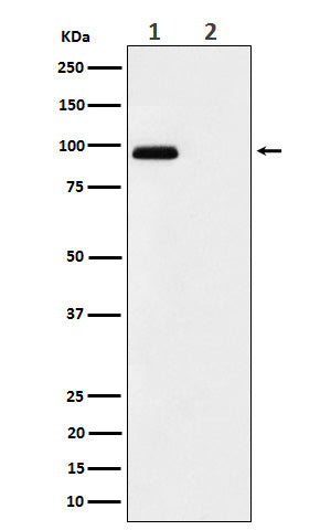 Anti-Phospho-FGFR3 (Y724) Rabbit Monoclonal Antibody Boster Bio
