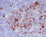 Anti-Phospho-Cdk1/2 (T14) Rabbit Monoclonal Antibody Boster Bio