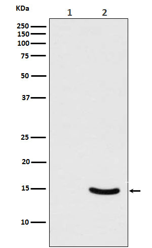 Anti-Phospho-alpha Synuclein (S129) SNCA Rabbit Monoclonal Antibody Boster Bio
