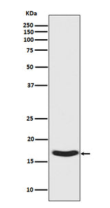 Anti-Phospho-alpha Synuclein (S129) SNCA Rabbit Monoclonal Antibody Boster Bio