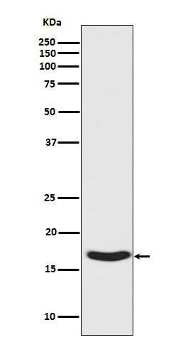 Anti-Phospho-alpha Synuclein (S129) SNCA Rabbit Monoclonal Antibody Boster Bio