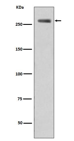 Anti-Phospho-LRRK2 (S935) Rabbit Monoclonal Antibody Boster Bio
