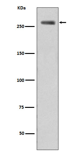 Anti-Phospho-LRRK2 (S935) Rabbit Monoclonal Antibody Boster Bio
