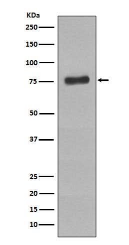 Anti-Phospho-BTK (Y223) Rabbit Monoclonal Antibody Boster Bio