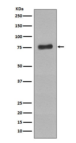 Anti-Phospho-BTK (Y223) Rabbit Monoclonal Antibody Boster Bio