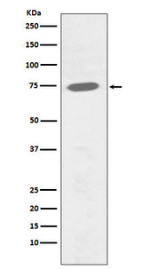 Anti-Phospho-BTK (Y551) Rabbit Monoclonal Antibody Boster Bio