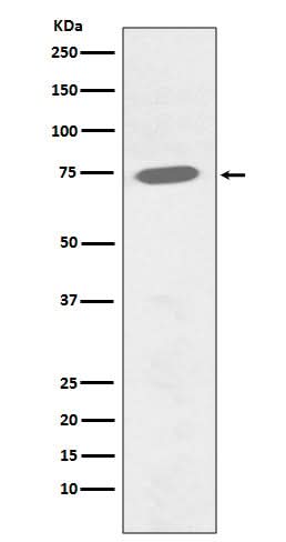 Anti-Phospho-BTK (Y551) Rabbit Monoclonal Antibody Boster Bio