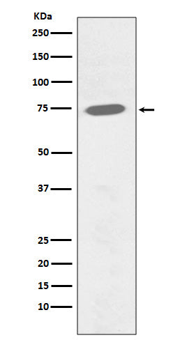 Anti-Phospho-BTK (Y551) Rabbit Monoclonal Antibody Boster Bio