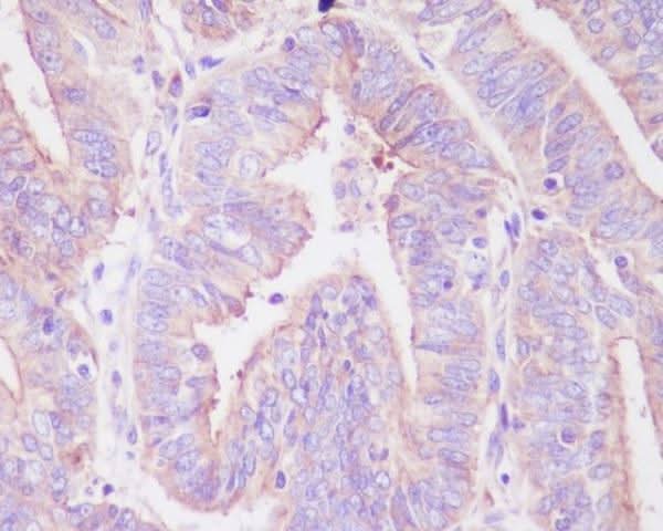 Anti-Phospho-FoxO3a (S253) Rabbit Monoclonal Antibody Boster Bio