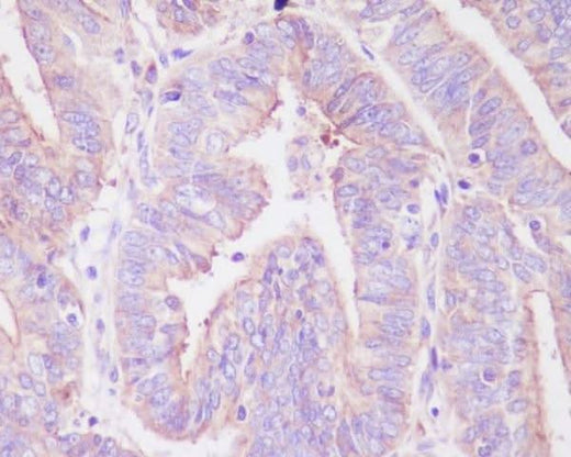 Anti-Phospho-FoxO3a (S253) Rabbit Monoclonal Antibody Boster Bio