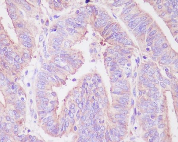 Anti-Phospho-FoxO3a (S253) Rabbit Monoclonal Antibody Boster Bio