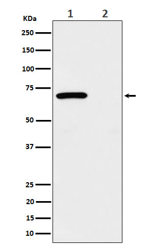 Anti-Phospho-Chk2 (T68) Rabbit Monoclonal Antibody Boster Bio