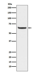 Anti-Phospho-NF-Kappa B p65 (S529) RELA Rabbit Monoclonal Antibody Boster Bio