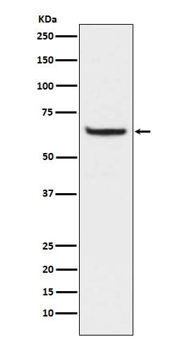 Anti-Phospho-NF-Kappa B p65 (S529) RELA Rabbit Monoclonal Antibody Boster Bio