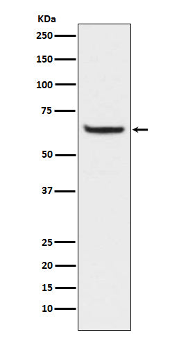 Anti-Phospho-NF-Kappa B p65 (S529) RELA Rabbit Monoclonal Antibody Boster Bio