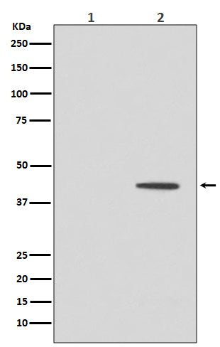 Anti-Phospho-MEK1 (T292) MAP2K1 Rabbit Monoclonal Antibody Boster Bio