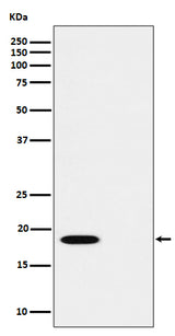 Anti-Phospho-PTS (S19) Rabbit Monoclonal Antibody Boster Bio