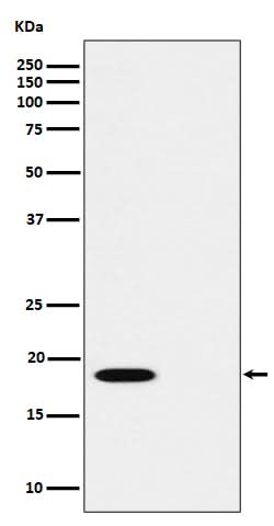 Anti-Phospho-PTS (S19) Rabbit Monoclonal Antibody Boster Bio
